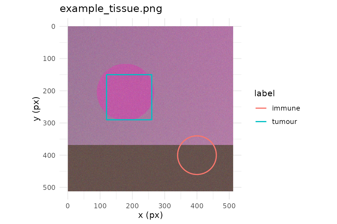 Tissue image with a tumour rectangle and immune circle drawn on top.